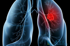 Сϸ���ΰ����ڻ��ߵ������ڲ���һ�Ŷ���