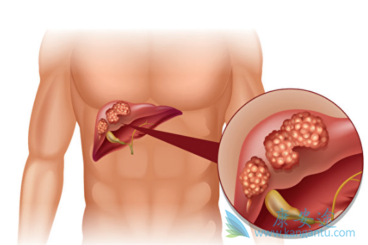 分子靶向治疗 分子靶向治疗