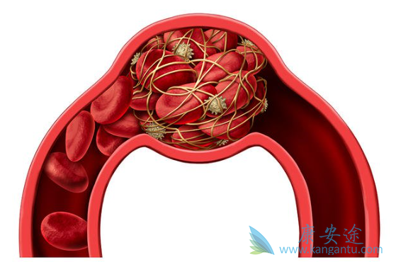 ��Ѫ��������֢״