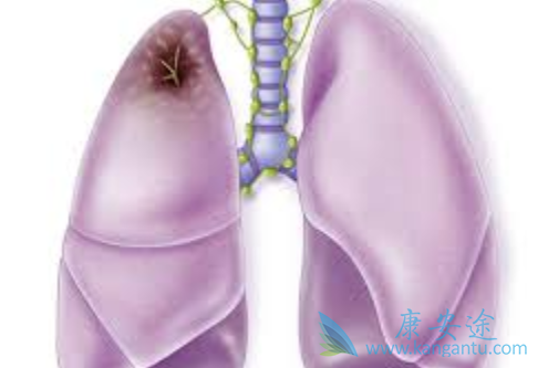 ��Сϸ���ΰ�