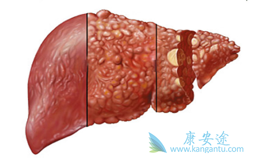 �ΰ����κ���