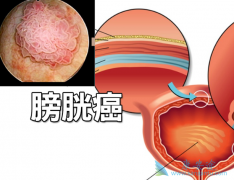 ���������ɽ��Ͱ��װ����ڸ�������