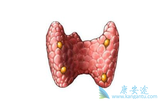 甲状腺腺瘤 甲状腺腺瘤