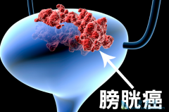 �ճ�����Ҫע���������װ�������֢״