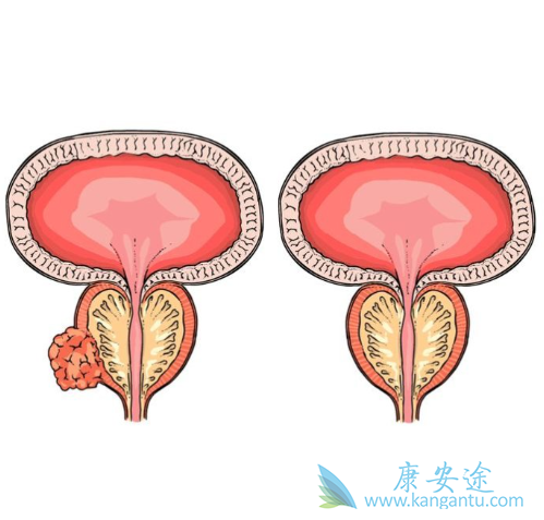 ǰ���ٰ�֢״