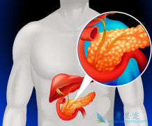 ���ٰ�����֢״��Ҫ����Ϊ������������Լ���