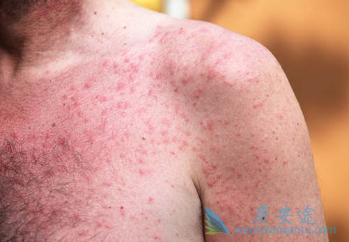 ������Ƥ��