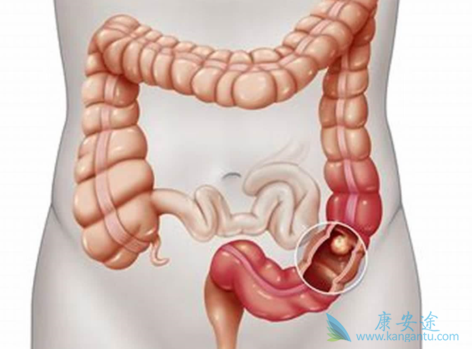 ��ֱ����