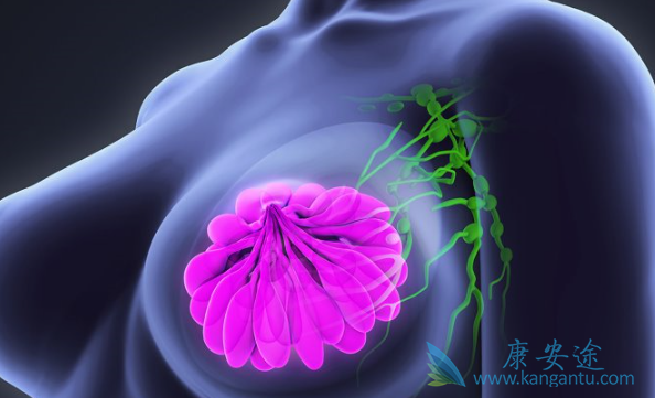 乳腺癌 乳腺癌