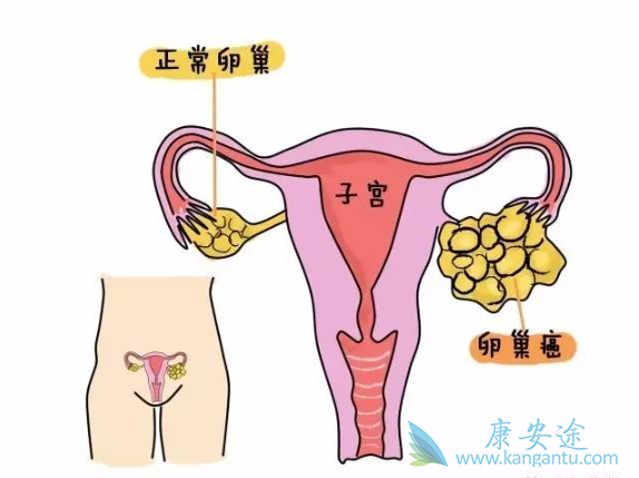 �ѳ���������֢״