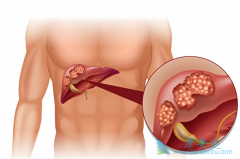 �ΰ�����֢״����һ�㶼����Щ��