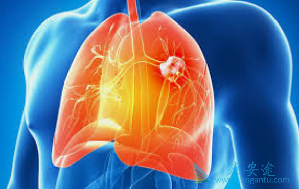 �ΰ���������