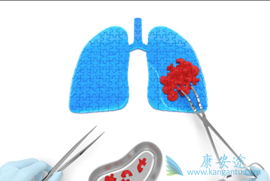 �ΰ������ܻ���