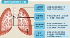 Сϸ���ΰ�����Ŀǰȡ������Щ��չ��