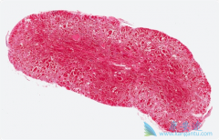 ��ɼ���뱴��������������Ѫ��������Ч����ǿ��