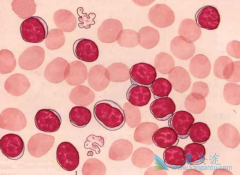 ��Щ�����ܰ�ϸ����Ѫ��������Ҫ���ƣ�