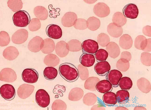 �����ܰ�ϸ����Ѫ��