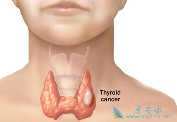 ��֢�����ܻ���