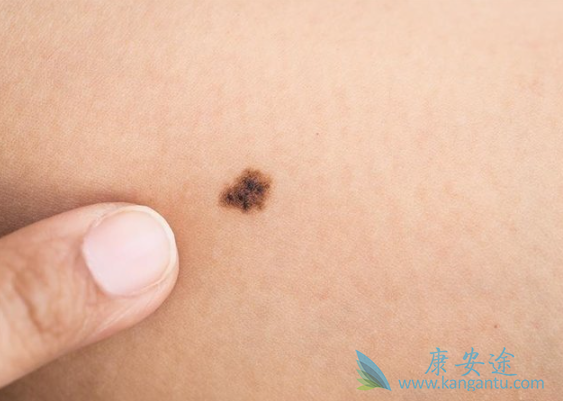 ��ɫ��������֢״