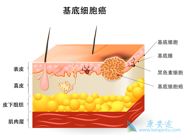 ����ϸ����