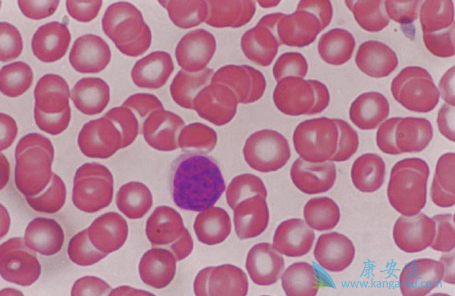 �����ܰ�ϸ����Ѫ��