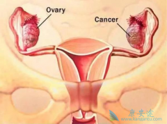 �ѳ�����֢״����Щ����ЩŮ�Ը��׻����ѳ�����