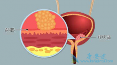 ���ڰ��װ�֢״ͨ��������Щ��