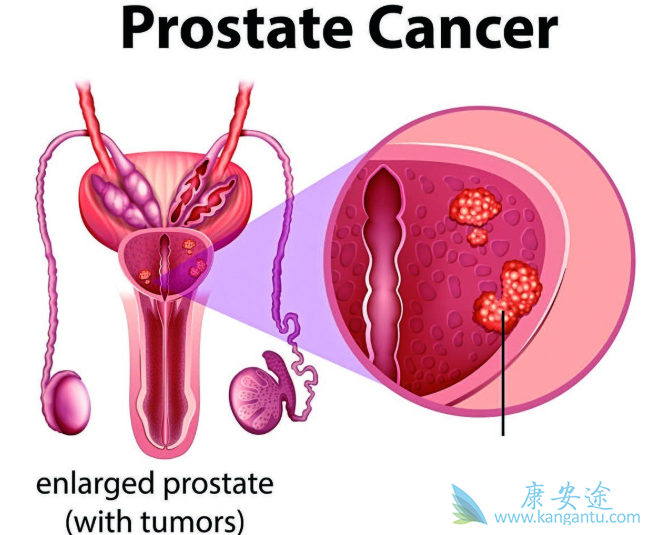 ǰ���ٰ��ܻ���