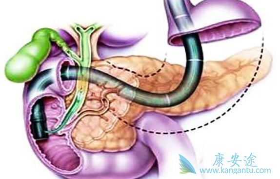 ���ٰ���֢״