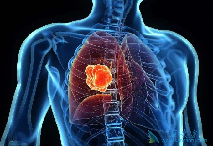 �ΰ���ת��