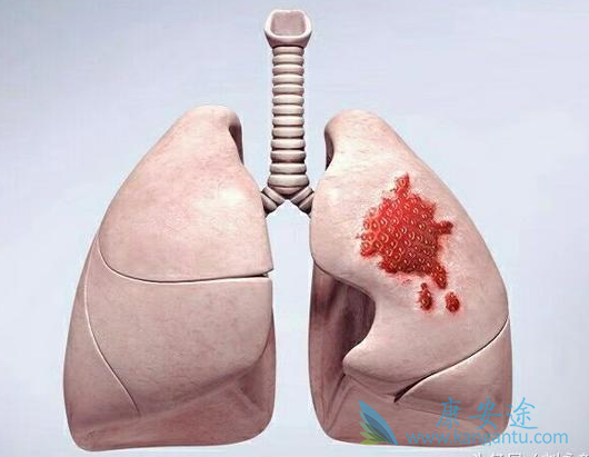 �ΰ���������