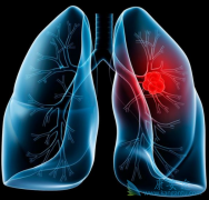 �������Ͷ���EGFR-TKI����������ȸ����÷�����ʲô��ͬ��