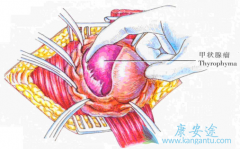 ��״����֢״�ͼ�״�������Ʒ�������