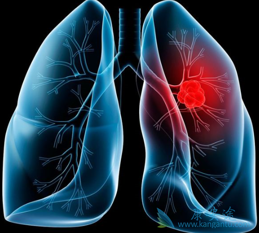 �ΰ���ת��֢״