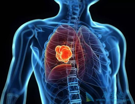 �ΰ���������