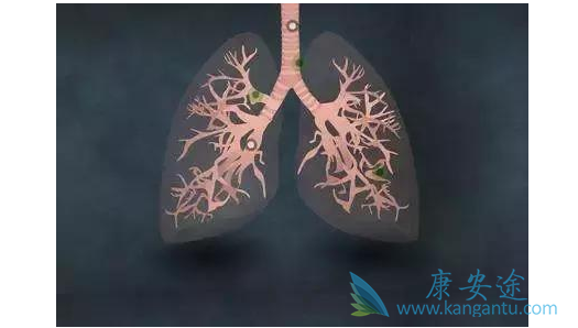 �ΰ��������κ���