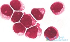 ��Щ֢״�����ǰ�Ѫ��ǰ�ף�