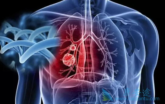 色瑞替尼 色瑞替尼