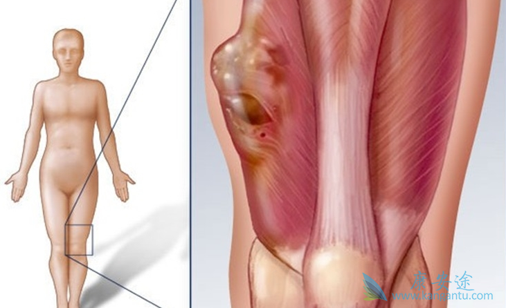 ֬������