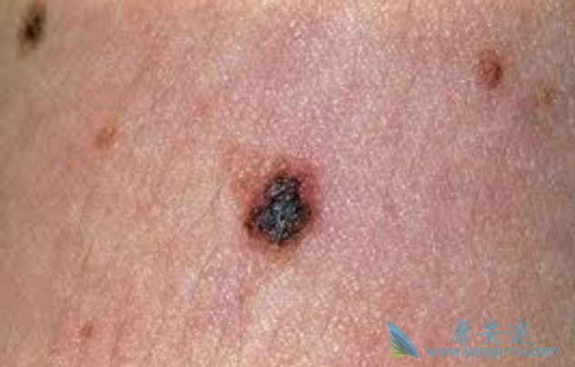 ���Ժ�ɫ����