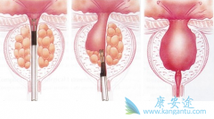 ��������ҩ����ķ���������ڰ��װ����ڵĶ�������