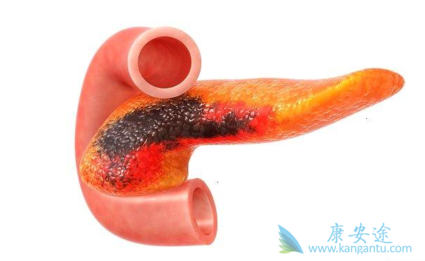 ���ٰ�����֢״