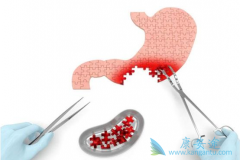 ʲô������ת�ƣ�����ת�ƻ������Щ֢״��