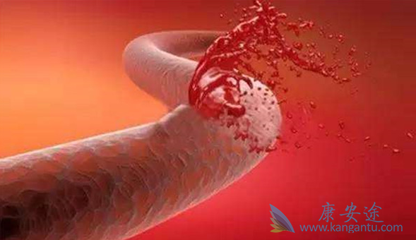 θ��Ѫ��ô��