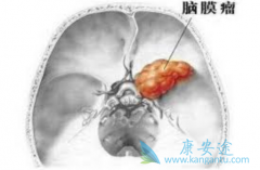 ����ж���������֮�����費��Ҫ���ܻ��ƣ�