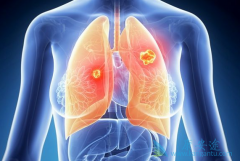 �ΰ�����֢״����Щ������Щ���Ʒ�������ѡ��