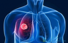 ��ķ������������������Ϊ���·ΰ����Ʒ�������Ч��ô����