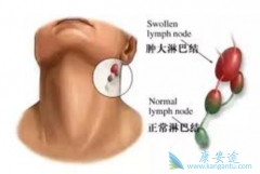 �ǻ�����ܰ���֢״����ͨ������Щ��