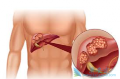 �Կ��ΰ�ҩ�ַ�����ΰ����κ���