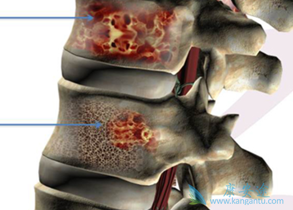 ���������κ���